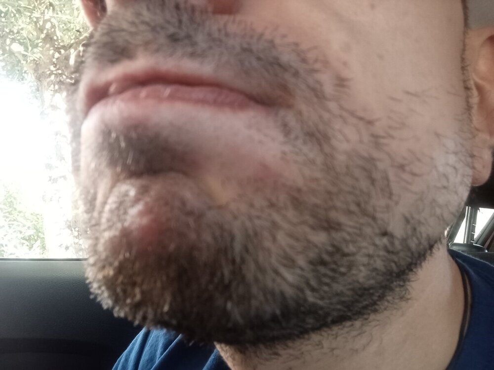 dopo_fucicort.jpg