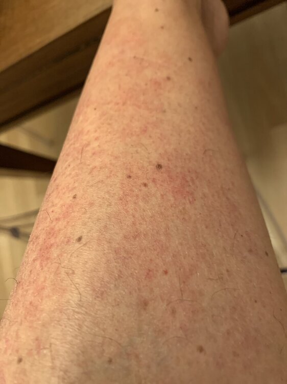 image.jpg