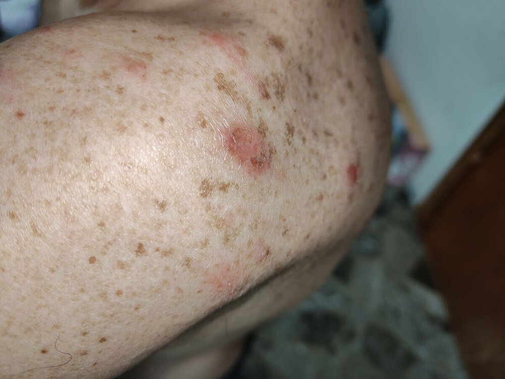 1000111307.jpg