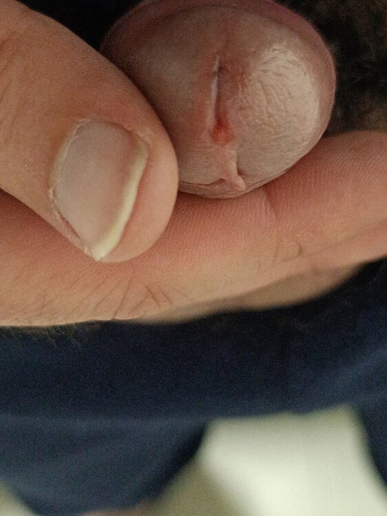 17326570821497424502314723434754.thumb.jpg.93aa1a9b39648e3c78ce21259647d041.jpg
