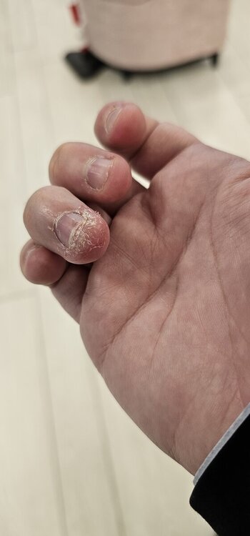 20241120_091718.thumb.jpg.7963fe8eb773e014bb16d91ee93b457a.jpg