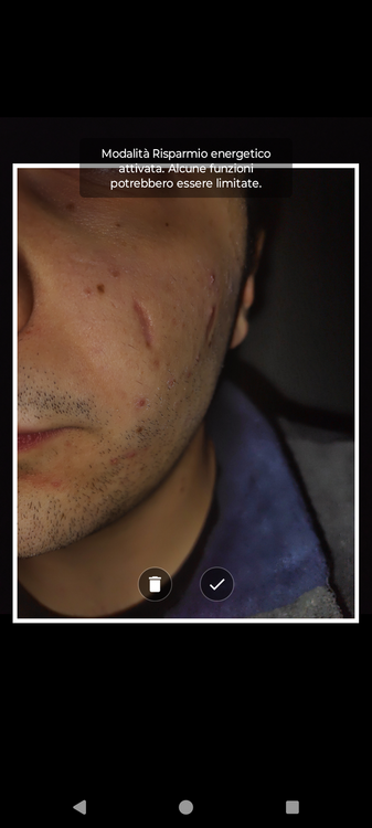Screenshot_20241118-235549.thumb.png.15fb9b266b6143a587e9be3332338e21.png