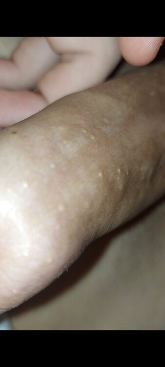 Screenshot_20241120_105754_Gallery.thumb.jpg.5c3ca9a05f5acbae1ade5c017482dc4f.jpg
