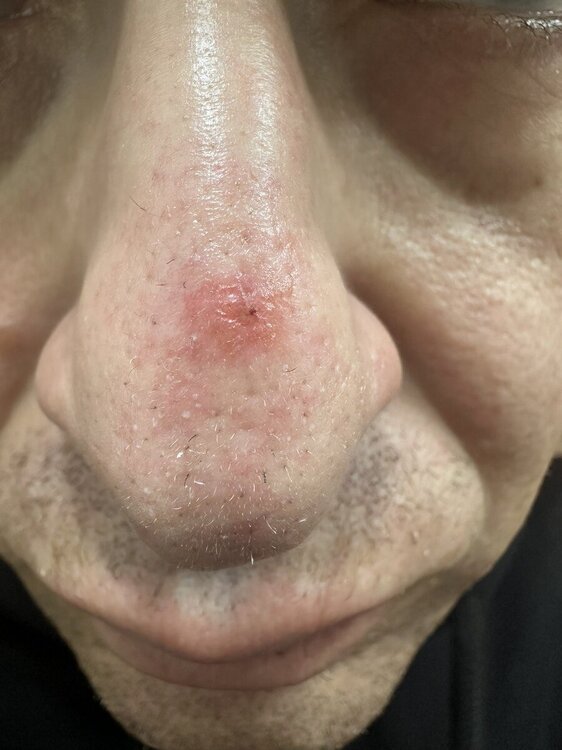 prima.thumb.jpg.3e902283c582429f4f2c99461074ee31.jpg