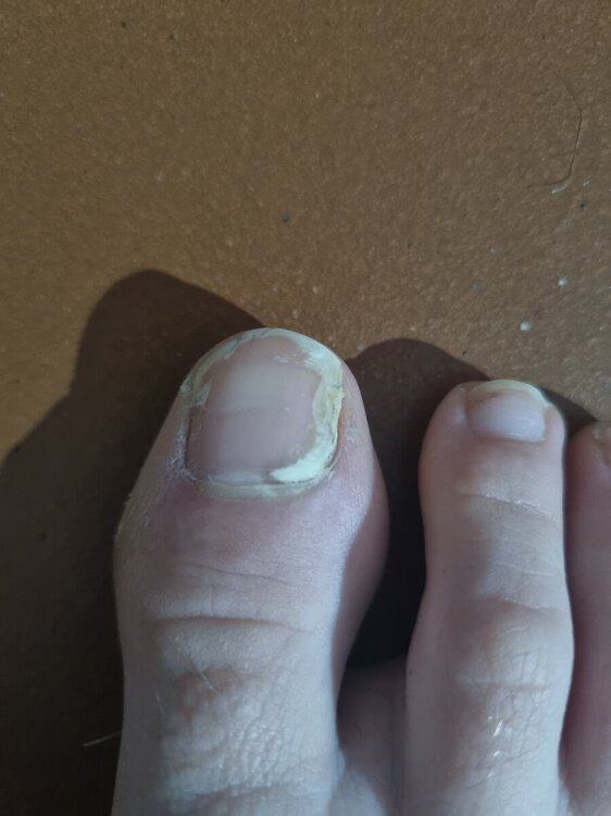 17334232345842408814327084268587.thumb.jpg.10934dd524276d9efa989c4d088ebdcc.jpg