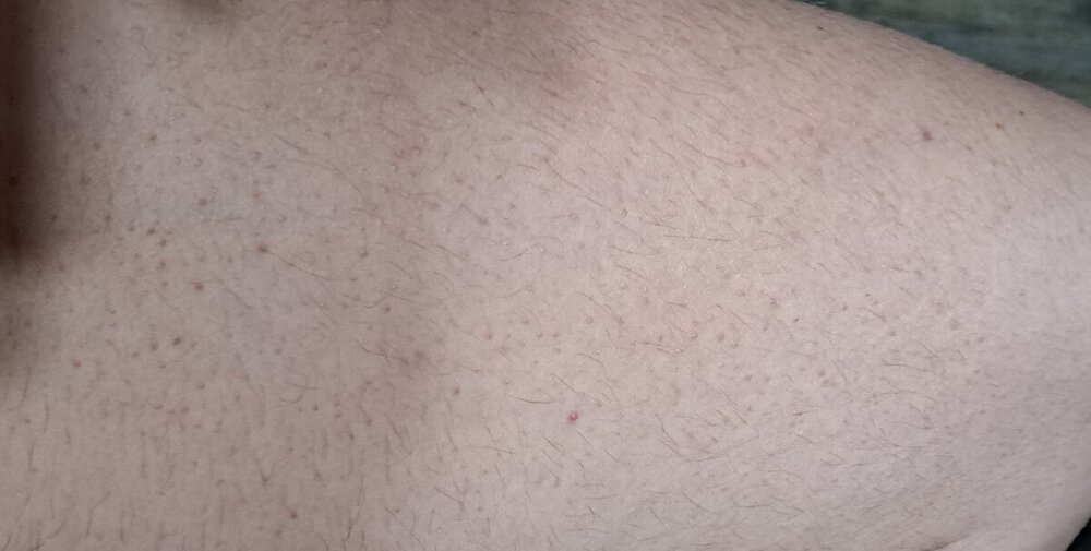20241207_170922.thumb.jpg.bdf891b41a7ad1a5030d419db5a86f0b.jpg