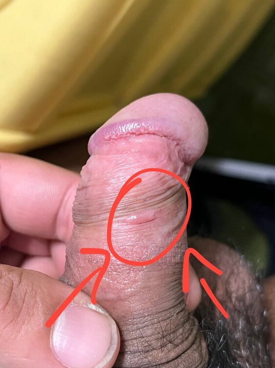 Bolla.thumb.jpg.b7d6057b49354c7c21b25703c81b7740.jpg