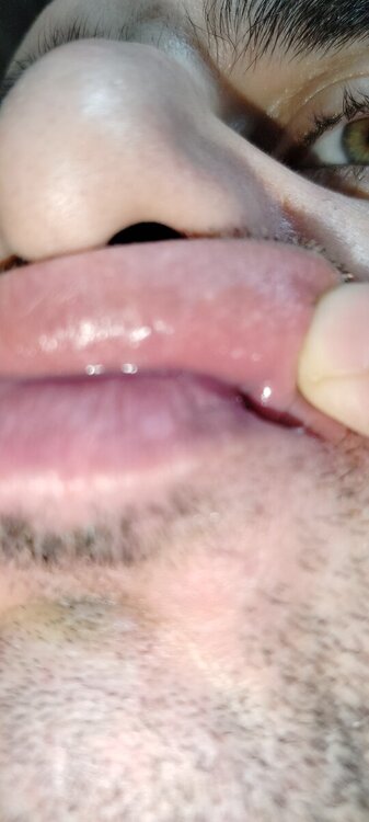 IMG20241202194648.jpg