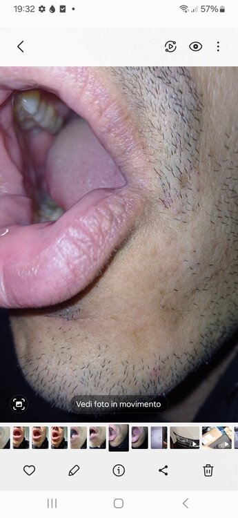 Screenshot_20241205_193211_Gallery.thumb.jpg.65d6d13df53c7722ae5b89a0e953f2d5.jpg