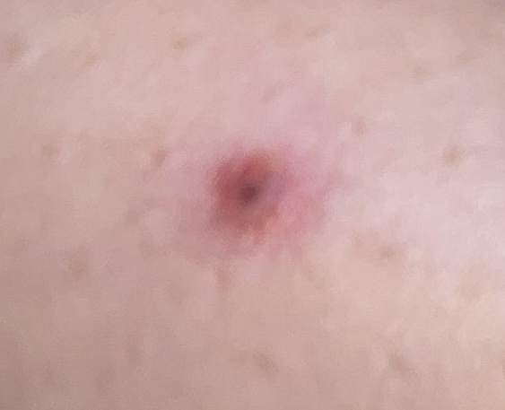 Allegato immagine