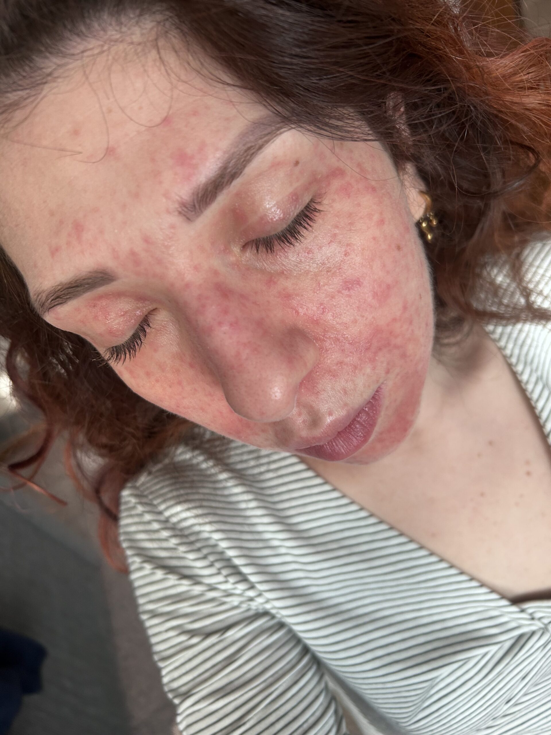 Allegato immagine