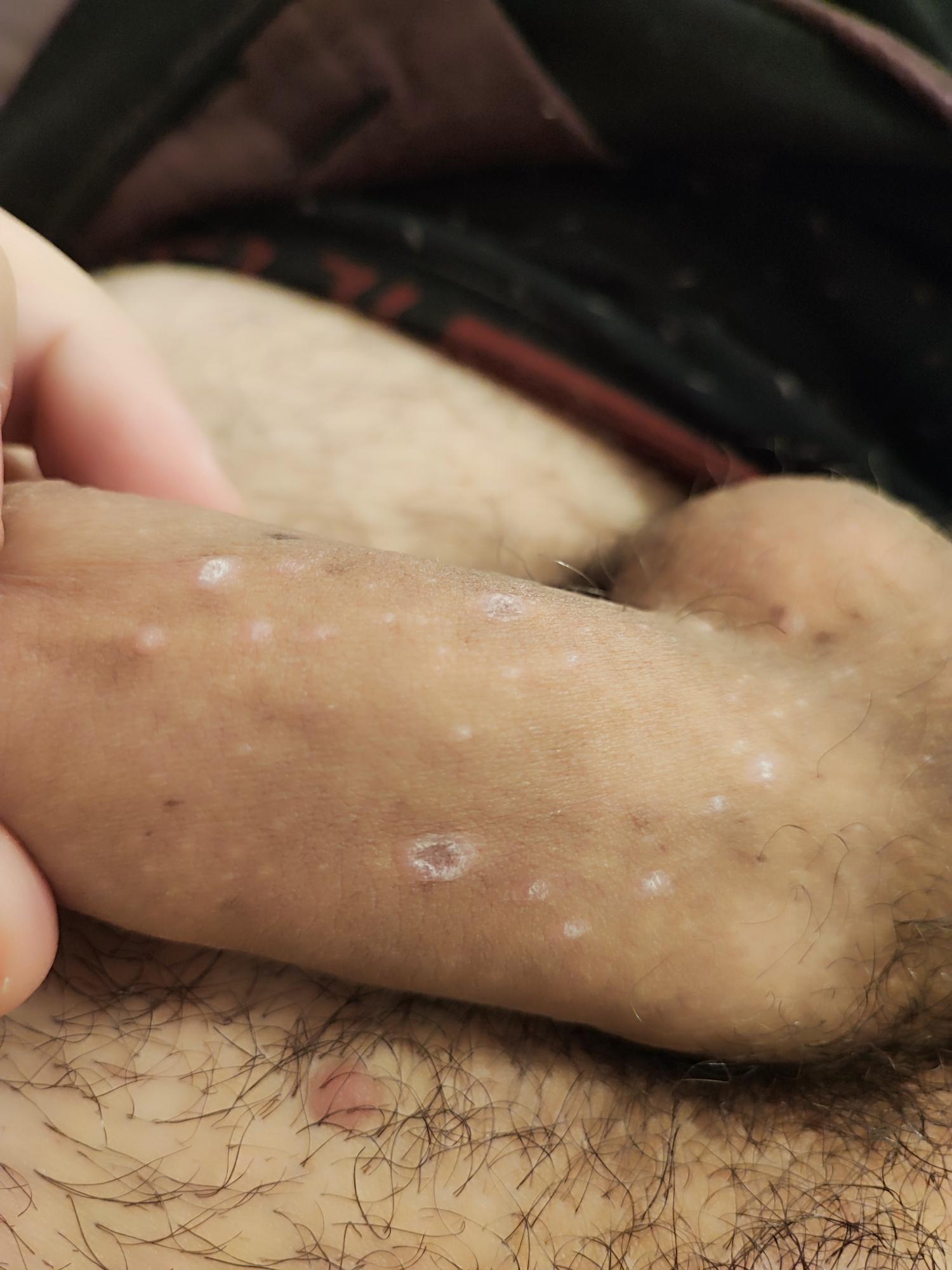 Allegato immagine